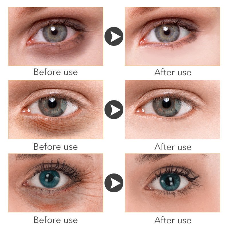 Beauty Eye Cream30mlwish Women's Skin Care Products - VIRALCORE HEALTH