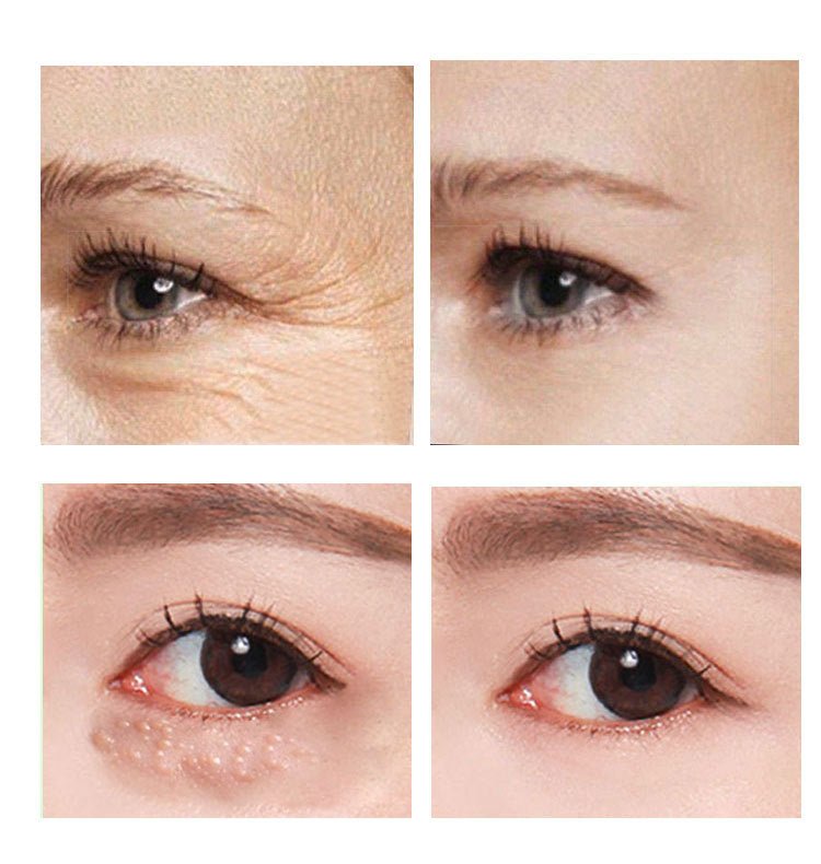 Beauty Eye Cream30mlwish Women's Skin Care Products - VIRALCORE HEALTH