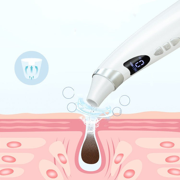 Electric Visual Blackhead Suction Instrument Household Cleansing Pore - VIRALCORE HEALTH